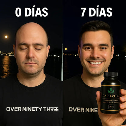 CapilVita – Suplemento Anticaída Capilar Natural (30 cápsulas)